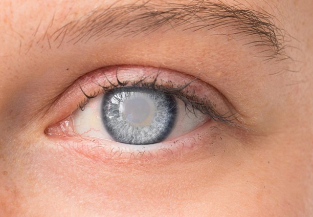 Diabetic Retinopathy Treatment